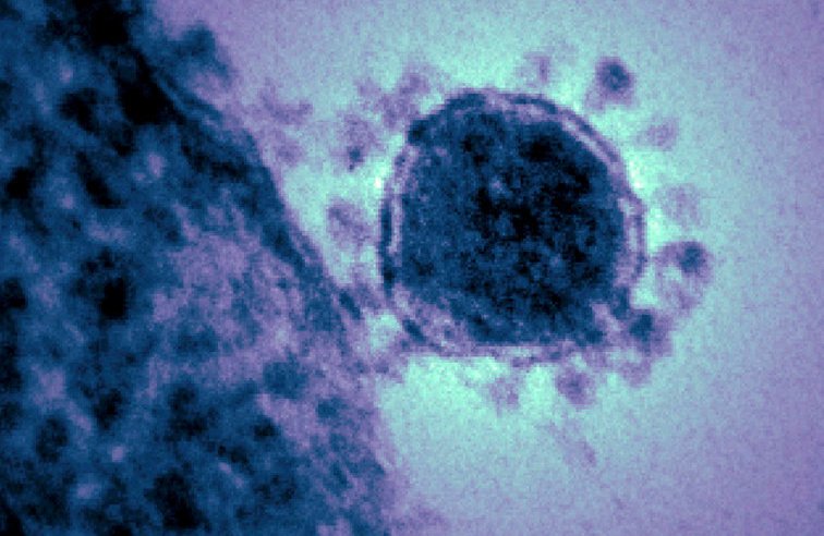 Coronavirus. Avec le virus se propagent aussi de nombreux préjugés racistes envers les asiatiques