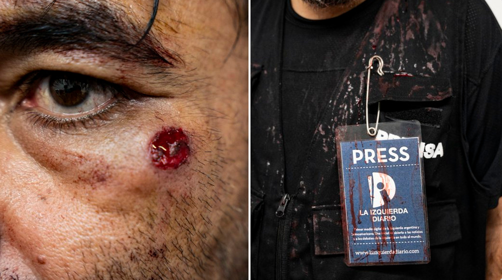 Répression sanglante en Argentine : des journalistes visés par la police, un avocat du FIT-U touché à l'œil