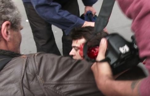 Manifestant grièvement blessé : la version de la police démentie par l'enquête