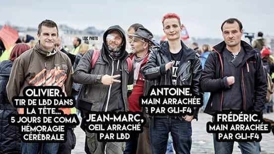 A Bordeaux, un collectif en solidarité avec les "gueules cassées” par la répression policière