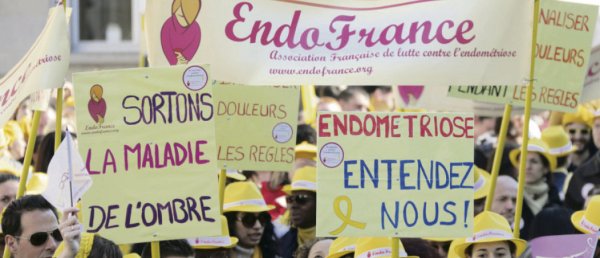 Coup de com' : Macron annonce un plan de lutte contre l'endométriose… sans moyens ni date