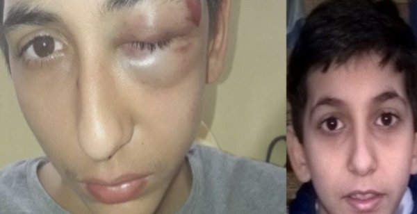 Roué de coups par des policiers, Gabriel 14 ans a cru « mourir en garde à vue »