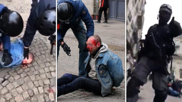 « Nantes History X » : Le manifestant blessé par la BAC condamné à 6 mois ferme !