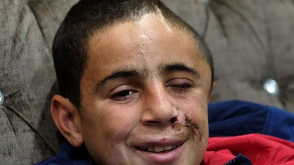  Le cousin d'Ahed a eu le crâne brisé par une balle en caoutchouc tirée à bout portant