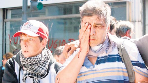 Argentine : Les images de la brutale répression que cachent le gouvernement et les grands médias.