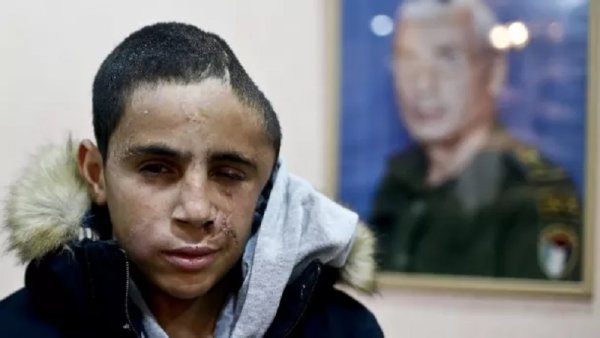 Israël violente, enferme et extorque de faux aveux à Mohammed Tamimi, 15 ans et cousin d'Ahed
