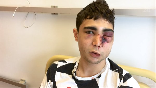 Mehdi, 21 ans, sauvagement tabassé par la police : “Je ne faisais que filmer…"