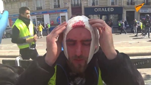 VIDEO. Un Gilet Jaune blessé à la tête près de la place de la république à Paris