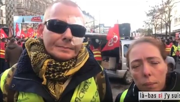 VIDEO. « J'ai perdu un œil, mais je suis toujours là ! », Manu éborgné à Paris toujours déterminé