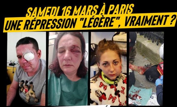 Plusieurs blessés graves sur les Champs-Élysées lors de l'Acte 18. Nous relayons ci-dessous un article de Nantes Révoltée.