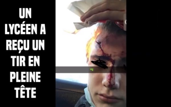 VIDEO. Compiègne : tirs de LBD, un lycéen gravement blessé à la tête