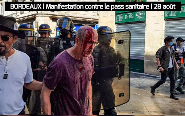 Vidéo. Manif Pass sanitaire : la police ouvre le crâne d'un retraité à Bordeaux