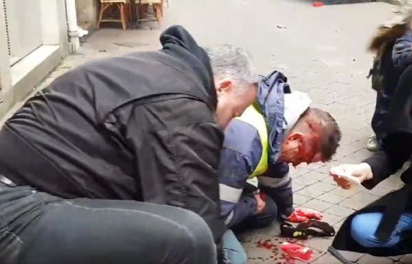 VIDEO. A Bordeaux, la BAC a encore frappé : un Gilet jaune victime d'un tir de flashball à la tête