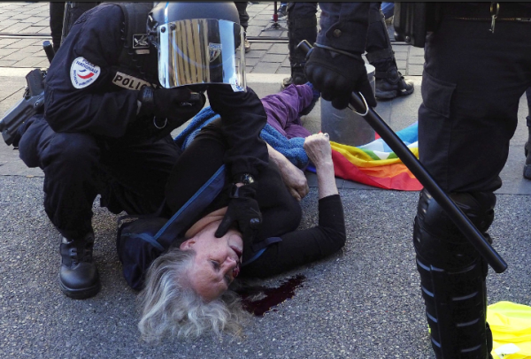 VIDEO. Nice. Femme gravement blessée : la police empêche les Streets Medics de soigner la victime