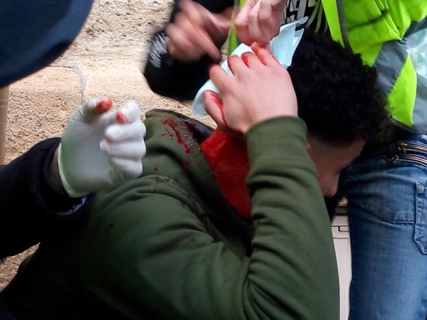 Montpellier. Tirs de flashball à la tête : deux jeunes blessés